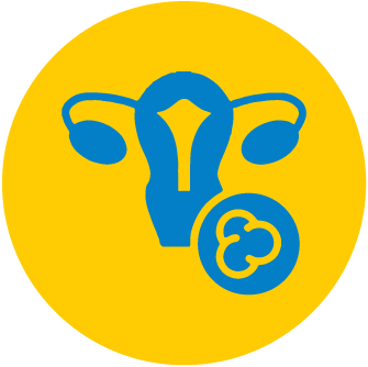 Ovarian cancer